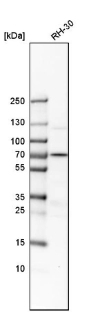 Western blot analysis in human cell line RH-30.