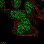 Immunofluorescent staining of human cell line RH-30 shows localization to nucleoplasm.