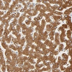 Anti-MAGEB17 Antibody