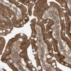 Immunohistochemical staining of human duodenum shows strong nuclear positivity in glandular cells.