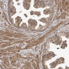 Immunohistochemical staining of human prostate shows moderate nuclear positivity in smooth muscle cells.