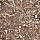 Immunohistochemical staining of human kidney shows strong cytoplasmic positivity in cells in tubules.