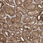 Immunohistochemical staining of human kidney shows strong cytoplasmic positivity in cells in tubules.