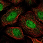 Immunofluorescent staining of human cell line SiHa shows localization to nucleoplasm & cytosol.