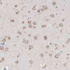 Immunohistochemical staining of human cerebral cortex shows strong nuclear positivity in neurons.