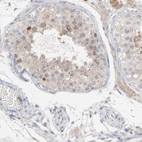 Immunohistochemical staining of human testis shows weak nuclear positivity in cells in seminiferous ducts.