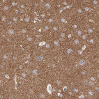 Anti-CPE Antibody