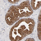 Immunohistochemical staining of human Prostate shows strong membranous and cytoplasmic positivity in glandular cells.