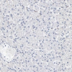 Immunohistochemical staining of human Liver shows very weak membranous positivity in hepatocytes.