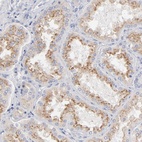 Anti-F12 Antibody