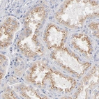 Anti-F12 Antibody