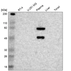 Western blot analysis in human cell line RT-4, human cell line U-251 MG, human plasma, human liver tissue and human tonsil tissue.