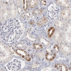 Anti-F13B Antibody