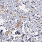 Immunohistochemical staining of human duodenum shows positivity in plasma in blood vessels.