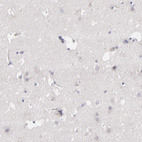 Immunohistochemical staining of human cerebral cortex shows no positivity in neurons as expected.