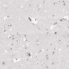 Immunohistochemical staining of human cerebral cortex shows no positivity in neurons as expected.
