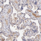 Immunohistochemical staining of human placenta shows positivity in plasma.