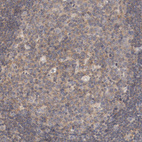 Anti-ZNF267 Antibody