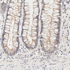Anti-ZNF267 Antibody
