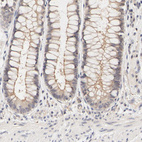 Immunohistochemical staining of human rectum shows weak membranous positivity in glandular cells.