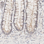 Immunohistochemical staining of human rectum shows weak membranous positivity in glandular cells.