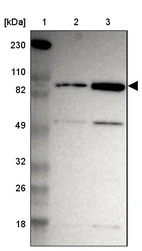 Lane 1: Marker [kDa] 230, 110, 82, 49, 32, 26, 18_br/_Lane 2: Human cell line RT-4_br/_Lane 3: Human cell line U-251MG sp