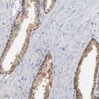 Anti-MIF Antibody