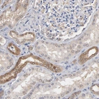 Immunohistochemical staining of human kidney moderate cytoplasmic positivity in cells in tubules.
