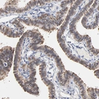 Immunohistochemical staining of human fallopian tube shows strong cytoplasmic positivity in glandular cells.