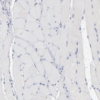 Immunohistochemical staining of human skeletal muscle shows no positivity in myocytes as expected.