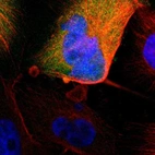Immunofluorescent staining of human cell line U-251 MG shows localization to cytosol.