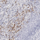 Anti-LTB4R Antibody
