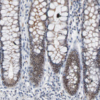 Anti-FOXP1 Antibody