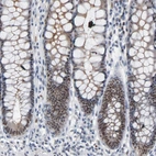 Immunohistochemical staining of human rectum shows moderate nuclear positivity in glandular cells.