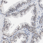 Anti-FOXP1 Antibody