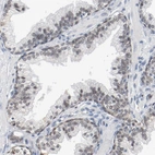 Immunohistochemical staining of human prostate shows weak nuclear positivity in glandular cells.