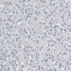 Anti-FOXP1 Antibody