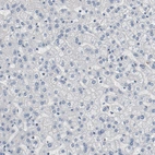 Immunohistochemical staining of human liver shows no positivity in hepatocytes as expected.