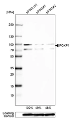 Western blot analysis in Caco-2 cells transfected with control siRNA, target specific siRNA probe #1 and #2, using Anti-FOXP1 antibody. Remaining relative intensity is presented. Loading control: Anti-GAPDH.