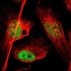Immunofluorescent staining of human cell line U-251 MG shows localization to nucleoplasm.