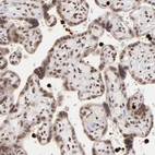 Immunohistochemical staining of human placenta shows moderate nuclear positivity in trophoblastic cells.
