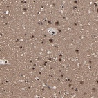 Immunohistochemical staining of human cerebral cortex shows high expression.