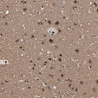 Immunohistochemical staining of human cerebral cortex shows high expression.