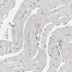 Immunohistochemical staining of human skeletal muscle shows low expression as expected.