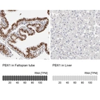 Anti-PBX1 Antibody