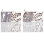 Immunohistochemical staining of human endometrium, fallopian tube, liver and prostate using Anti-PBX1 antibody HPA003881 (A) shows similar protein distribution across tissues to independent antibody HPA003505 (B).