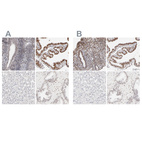 Anti-PBX1 Antibody