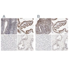 Immunohistochemical staining of human endometrium, fallopian tube, liver and prostate using Anti-PBX1 antibody HPA003881 (A) shows similar protein distribution across tissues to independent antibody HPA003505 (B).