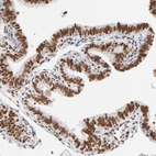 Immunohistochemical staining of human fallopian tube shows strong nuclear positivity in glandular cells.