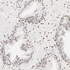 Anti-PBX1 Antibody